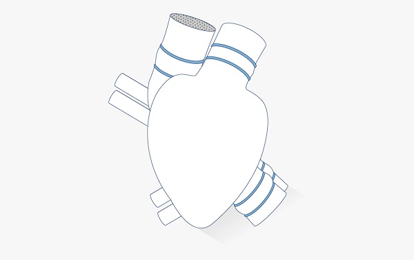 Artificial heart impeller pump