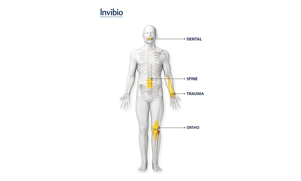 Implants Human